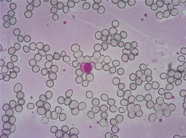 血液细胞显微图片