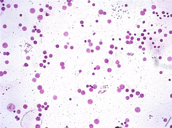 血液细胞显微图片